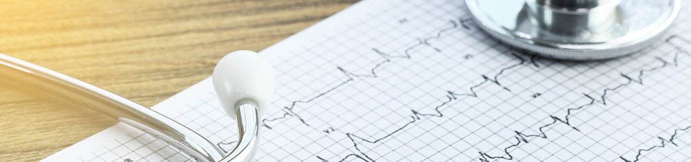 Serviço de Arritmias Cardíacas do HCor desenvolve nova técnica para o tratamento da fibrilação atrial
