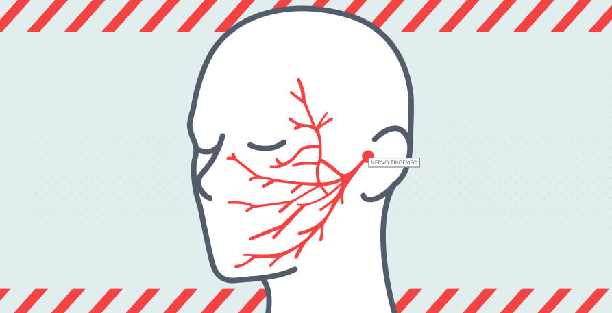Dor aguda no rosto? Pode ser Neuralgia do Trigêmio - Dra. Fabiana